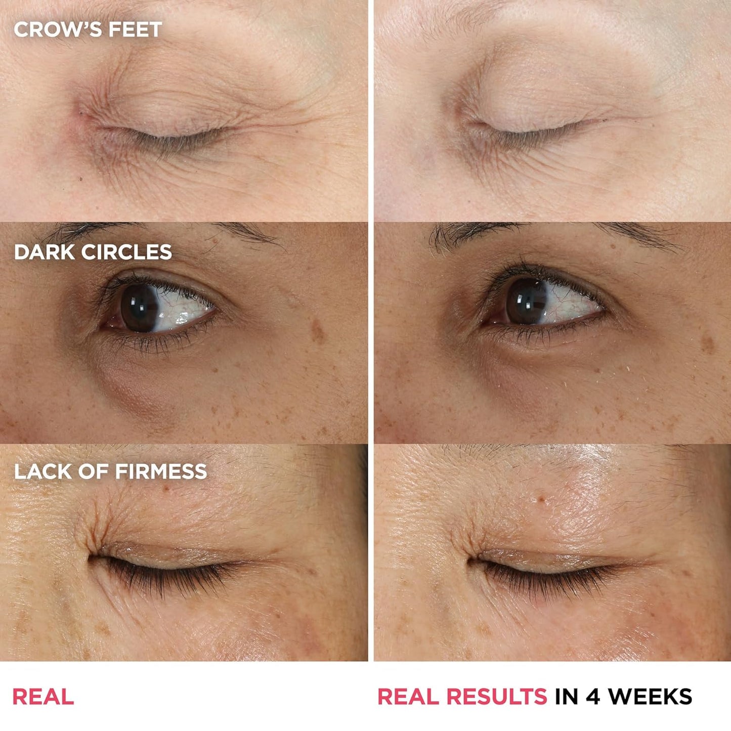 Anti Aging Peptide Eye Cream for Dark Circles & Wrinkles