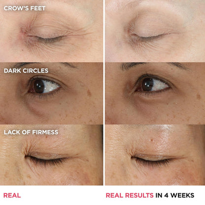 Anti Aging Peptide Eye Cream for Dark Circles & Wrinkles